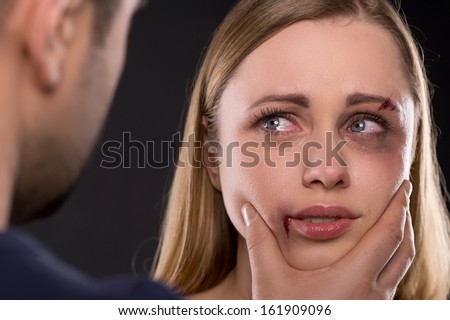 Close up of crying scared female face with bruise. Man holding woman face aggressively  - stock photo