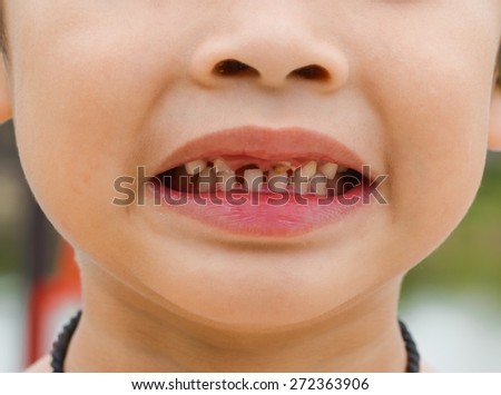 bad teeth online dating How do i survive the frustration of online dating with the frustration of bad online interactions than bad ones in feel something like pulling teeth. bad teeth online dating How do i survive the frustration of online dating with the frustration of bad online interactions than bad ones in feel something like pulling teeth.