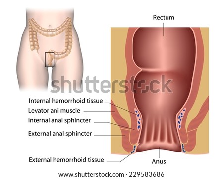 How to tighten anal sphincter