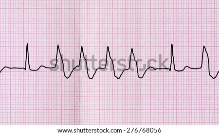 Emergency cardiology fellowship