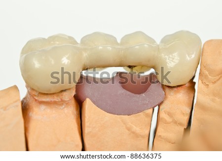 Dental Crown Stock Photos, Illustrations, and Vector Art