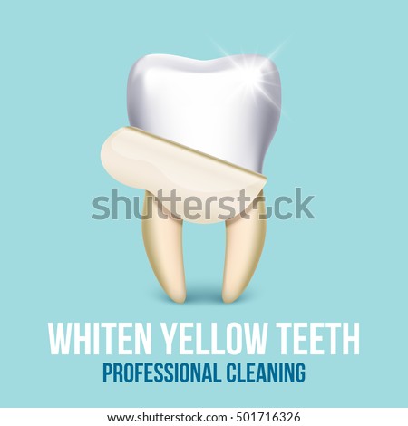 Tooth veneer whitening dental technician vector concept. Healthcare stomatology and cleaning professional teeth illustration Tooth veneer whitening dental technician vector concept. Healthcare stomatology and cleaning professional teeth illustration