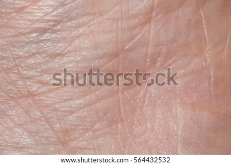 background of the human skin macro stock photo 156617564 liver spot on skin person stock photo 73743664 background of the human skin macro stock photo 156617564 liver spot on skin person stock photo 73743664