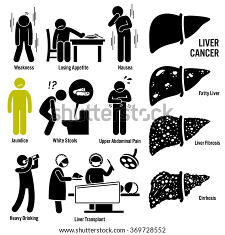 prostate most cancers remedy prices australia