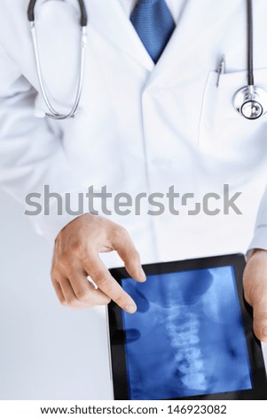 close up of male doctor holding tablet pc with x-ray - stock photo