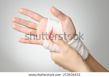 stock-photo-injured-hand-with-bloody-white-gauze-bandage-213636652.jpg