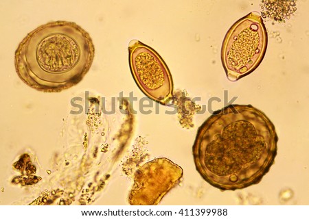 Egg Helminth Stool Analyze By Microscope Stock Photo 411399988 ...