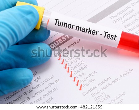 Blood Sample Tumor Marker Test Stock Photo 482121355 ...
