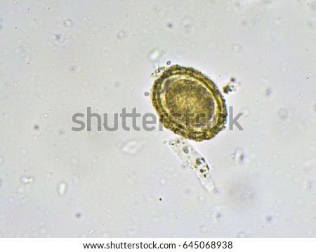 Egg Ascaris Lumbricoides Roundworm Stool Analyze Stock Photo (Edit Now ...