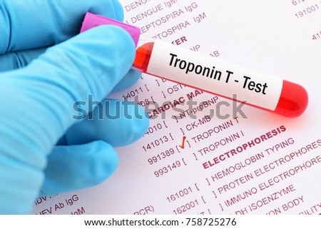 heart trop-t test attack Patient Failure Images Heart Free Royalty Images, Stock