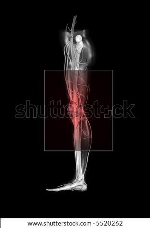 Cialis back and leg pain