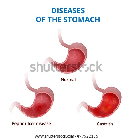 Stomach Anatomy Diagram Human Digestive Organ Stock Illustration ...