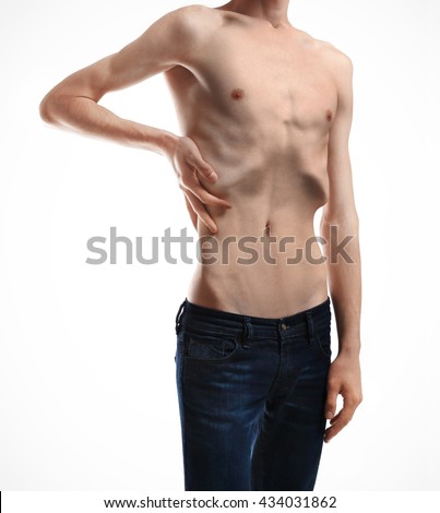 Malnourished Stock Images, Royalty-Free Images & Vectors | Shutterstock