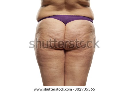 Foto topless pesta sex Nude fat wife with stretch marks