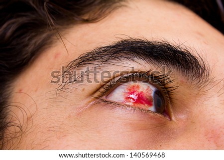 conjunctiva