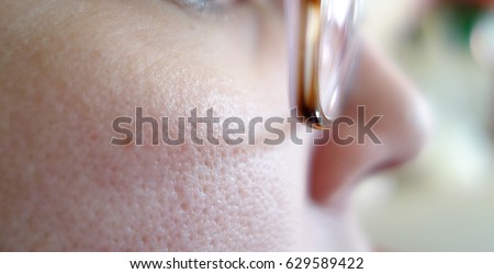 skin pores stock images royalty free images vectors skin pores stock images royalty free images vectors skin pores stock images royalty free images vectors skin pores stock images royalty free images vectors