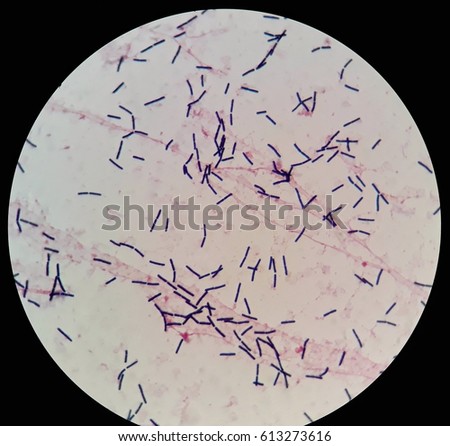 unknown bacteria bacillus subtilis Microbiology 20 biochemical unknown possible unknown bacterial species bacillus megaterium bacillus subtilis. unknown bacteria bacillus subtilis Microbiology 20 biochemical unknown possible unknown bacterial species bacillus megaterium bacillus subtilis.