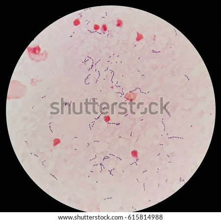 Smear Human Blood Culture Grams Stained Stock Photo (Royalty Free ...