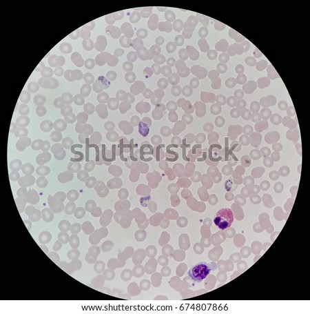malaria is passed to humans through a Malaria is a disease transmitted through the blood to humans by an infected female anopheles mosquito the primary symptoms are severe chills and fever if malaria is left untreated, it is often fatal. malaria is passed to humans through a Malaria is a disease transmitted through the blood to humans by an infected female anopheles mosquito the primary symptoms are severe chills and fever if malaria is left untreated, it is often fatal.
