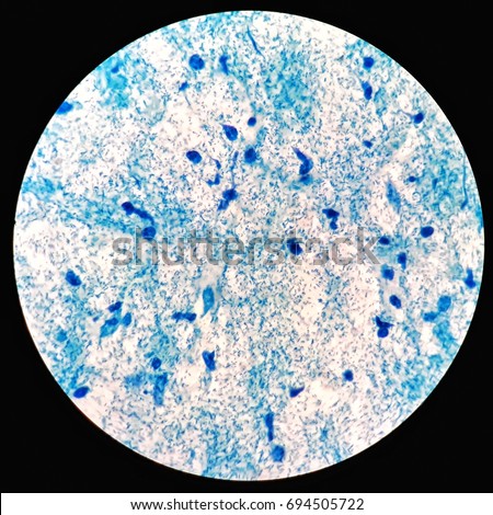 Smear Acidfast Bacilli Afb Stained Sputum Stock Photo 694613338 ...