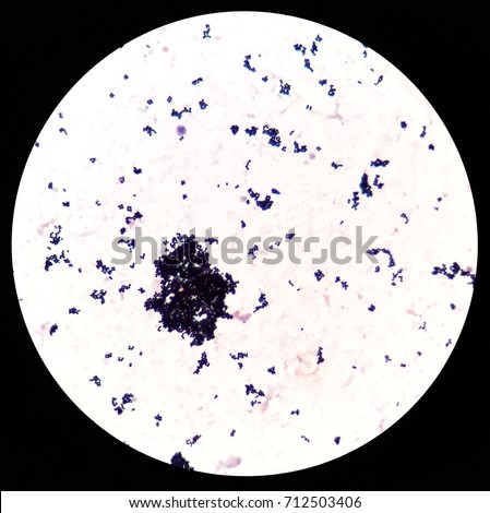 Gram Positive Cocci Blood Culture