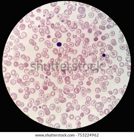 Smear Human Blood Cultured Grams Stained Stock Photo 709117111 ...