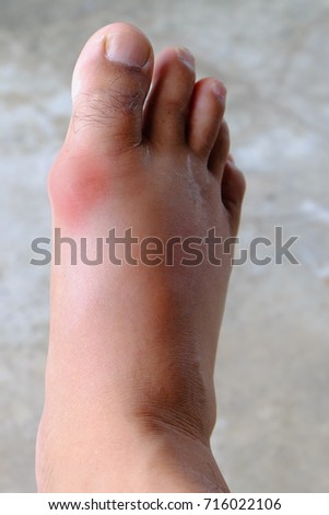 ray composition x film of &   Stock Images Royalty Free Gout Vectors Shutterstock Images,