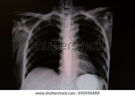 Will drinking water help me to lose weight photo 7
