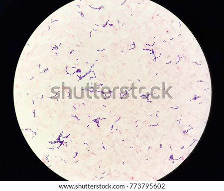 Smear Acidfast Bacilli Stained Afb Stain Stock Photo 736294630 ...