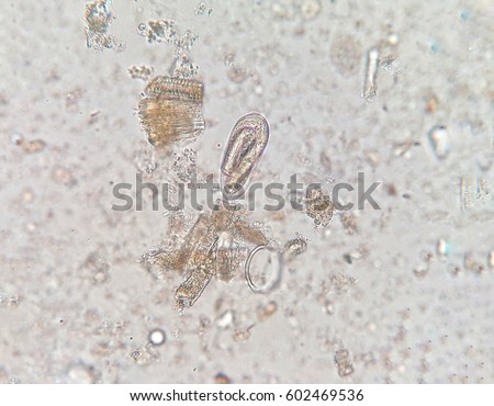 Enterobius Stock Images, Royalty-Free Images & Vectors ...
 Pinworm Eggs In Poop