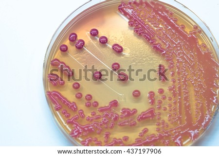 Pus-cells Stock Photos, Images, & Pictures | Shutterstock