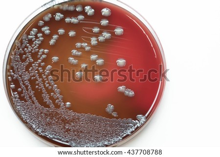 Close Media Plate Bacteria Culture Growth Stock Photo (Edit Now ...