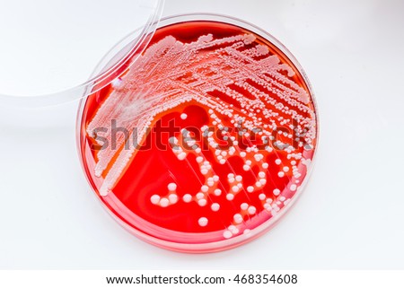 Staphylococcus Aureus Grampositive Gramvariable Nonmotile Coccusbeta ...