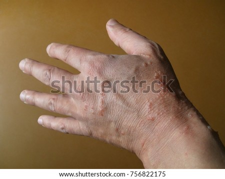 Summer Time Hogweed Heracleum Sphondylium Dangerous Stock Photo ...