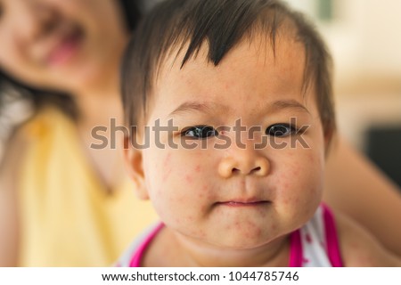 Epstein-barr Virus Stock Images, Royalty-Free Images ...