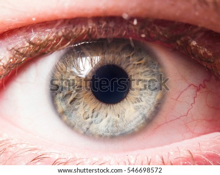 Eyeball Veins Stock Images, Royalty-Free Images & Vectors | Shutterstock