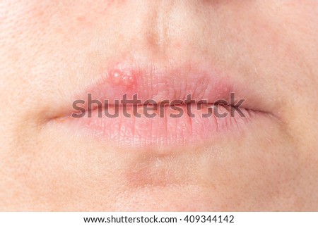 macro texture burns on human skin stock photo 415678729 macro texture burns on human skin stock photo 415678729 macro texture burns on human skin stock photo 415678729 macro texture burns on human skin stock photo 415678729
