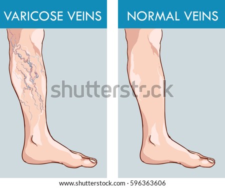 Download Legs Stock Images, Royalty-Free Images & Vectors ...