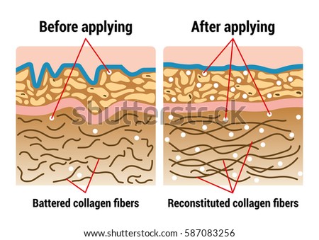 Human Skin Structure 3d Anatomy Epidermis Stock Vector 136222271 ...