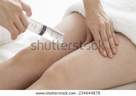 Twins weight loss study image 4