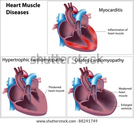 Pathway Blood Flow Through Heart Stock Illustration 76386163 - Shutterstock