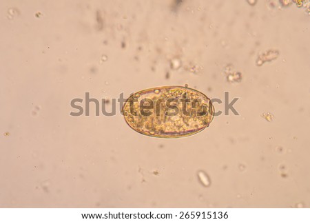 Trematoda Stock Photos, Royalty-Free Images & Vectors - Shutterstock