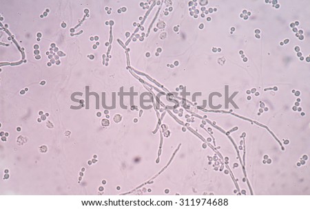 Branching Budding Yeast Cells Pseudohyphae Urine Stock Photo 311974688 ...
