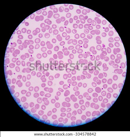 Thrombocytes Stock Photos, Images, & Pictures | Shutterstock