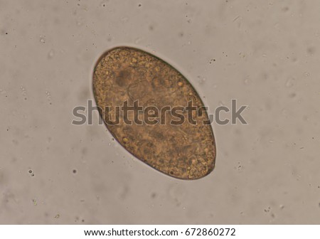 Pinworm Stock Images, Royalty-Free Images & Vectors | Shutterstock