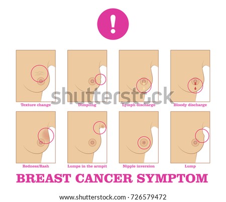 warning signs cancer pain breast