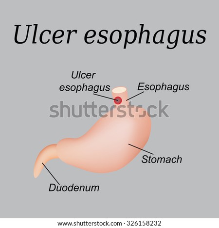 Esophagus Stock Photos, Images, & Pictures | Shutterstock