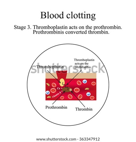 blood clotting 3 essay A defect in one of the genes that determines how the body makes blood clotting factor viii or ix causes hemophilia these genes are located on the x chromosomes (kro. blood clotting 3 essay A defect in one of the genes that determines how the body makes blood clotting factor viii or ix causes hemophilia these genes are located on the x chromosomes (kro.
