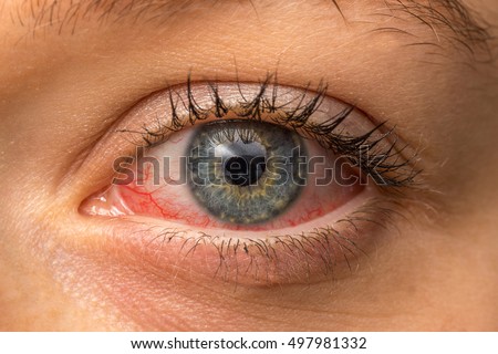 Eyeball Veins Stock Images, Royalty-Free Images & Vectors | Shutterstock