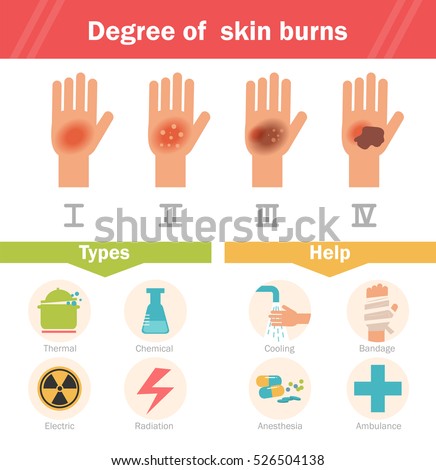 Degree Skin Burns Vector Cartoon Isolated Stock Vector 526504138 ...